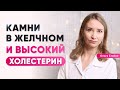 Почему при высоком холестерине страдает желчный пузырь?