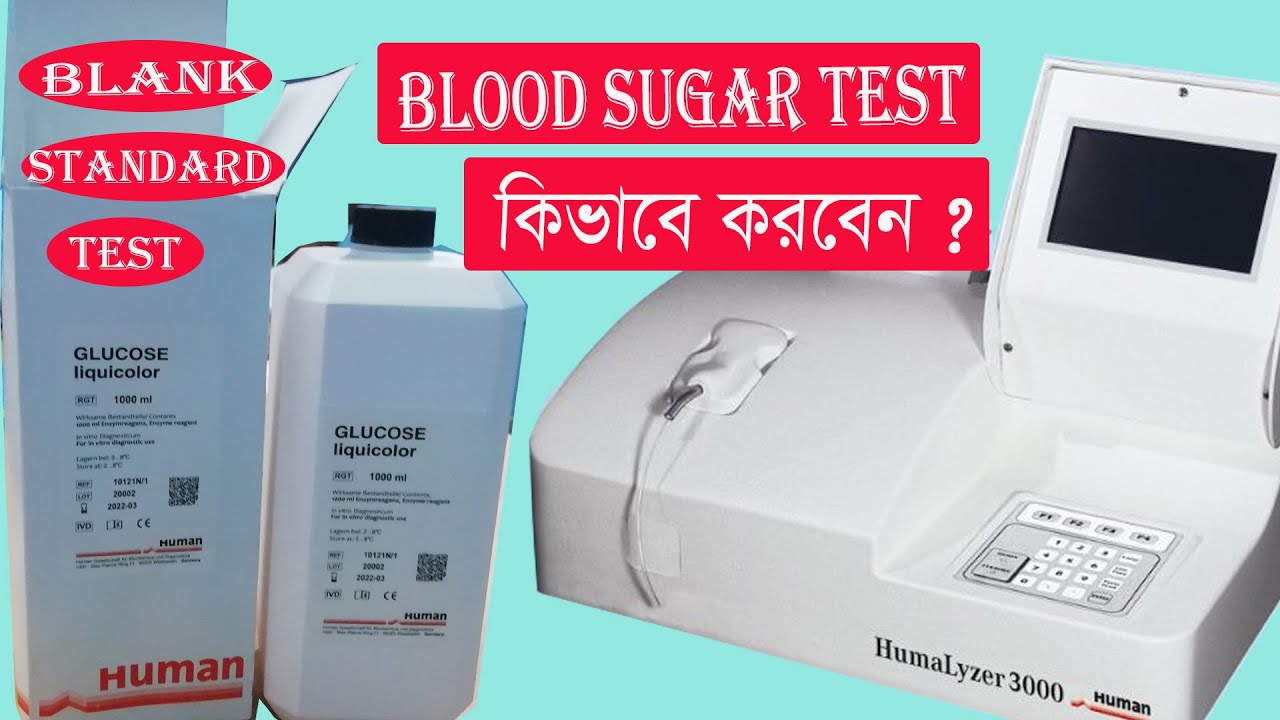 Serum Uric Acid Test in Bangla / How to calibration serum Uric