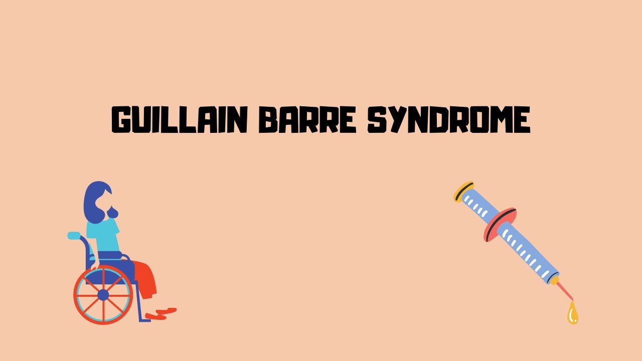 Guillain Barre Syndrome Types Clinical Features Diagnosis guillain-barre-syndrome-types-clinical-features-diagnosis