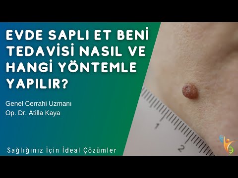 Evde Saplı Et Beni Tedavisi Nasıl ve Hangi Yöntemle Yapılır? - Op. Dr. Atilla KAYA - IDEA Klinik