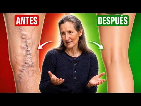 Rebota 5 Minutos al Día y Mira Qué Pasa Con Tus Venas
