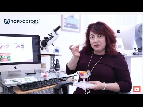 Lentes intraoculares de alta miopía - ¿Cómo es el proceso para saber si se es candidato?
