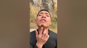 How I Cured a Bug Bite with Yogurt in the Wild | Survival Hacks🎉🎉🎉