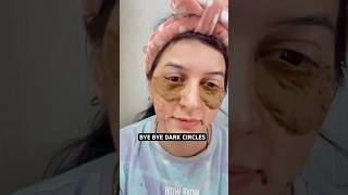 Dark Circles Ke Liye Ye Kabhi Ignore Mat Karna! #shorts #darkcircles #beautytips #skincare #glowup