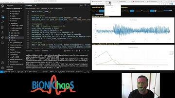 Biomedical Signal Analysis and how not to use GPT4