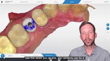 Tip of the Day: Gingival Mask