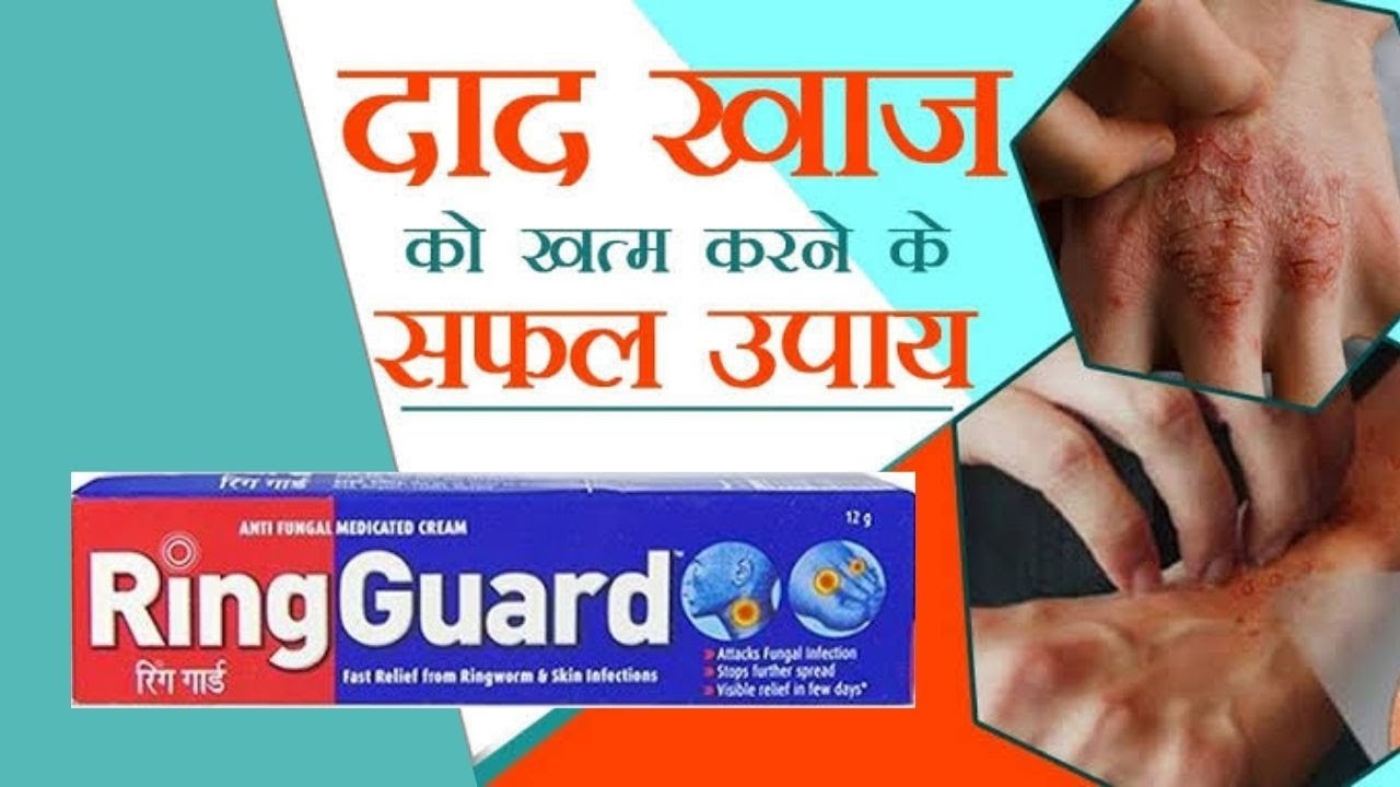 Ring Guard Cream Medicated Treatment for Ringworm (20 Gm) | Rigmeds