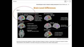 Webinar Dyslexia