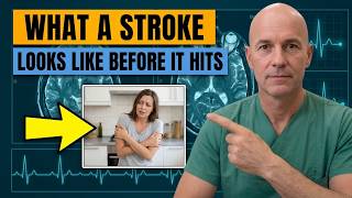 What a Stroke Looks Like the Day Before It Hits — Know This to Protect Yourself Profile