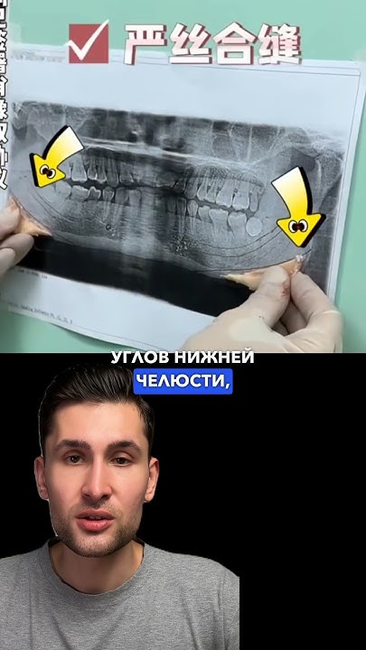 Ютуб уменьшился масштаб. Как уменьшить экран на ютубе. Как уменьшить масштаб ютуба на компьютере. Ютуб уменьшился масштаб. Уменьшился ютуб.