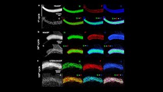 Structural and Chemical Evolution of Silicon and the Solid-Electrolyte Interphase (SEI) Layer
