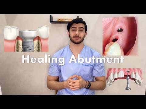 Video: Gjør implantatabutment vondt?