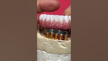 Introducing Removable zirconia!!!!!