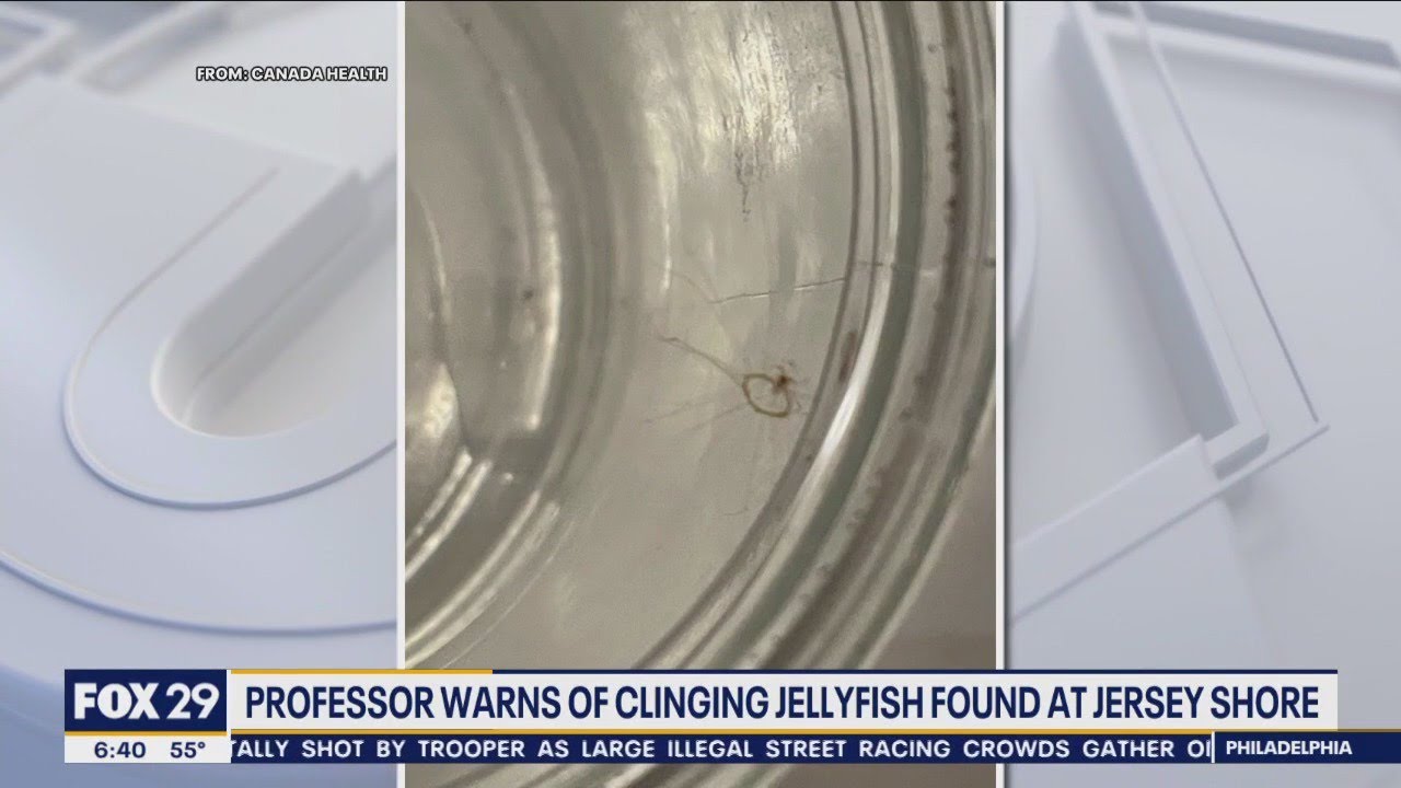 Professor warns of clinging jellyfish found at Jersey Shore