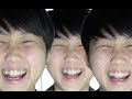 プチ整形しました!!!!!!!!!!!!