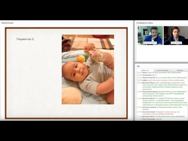 2-й вебинар для врачей по эмболизации маточных артерий