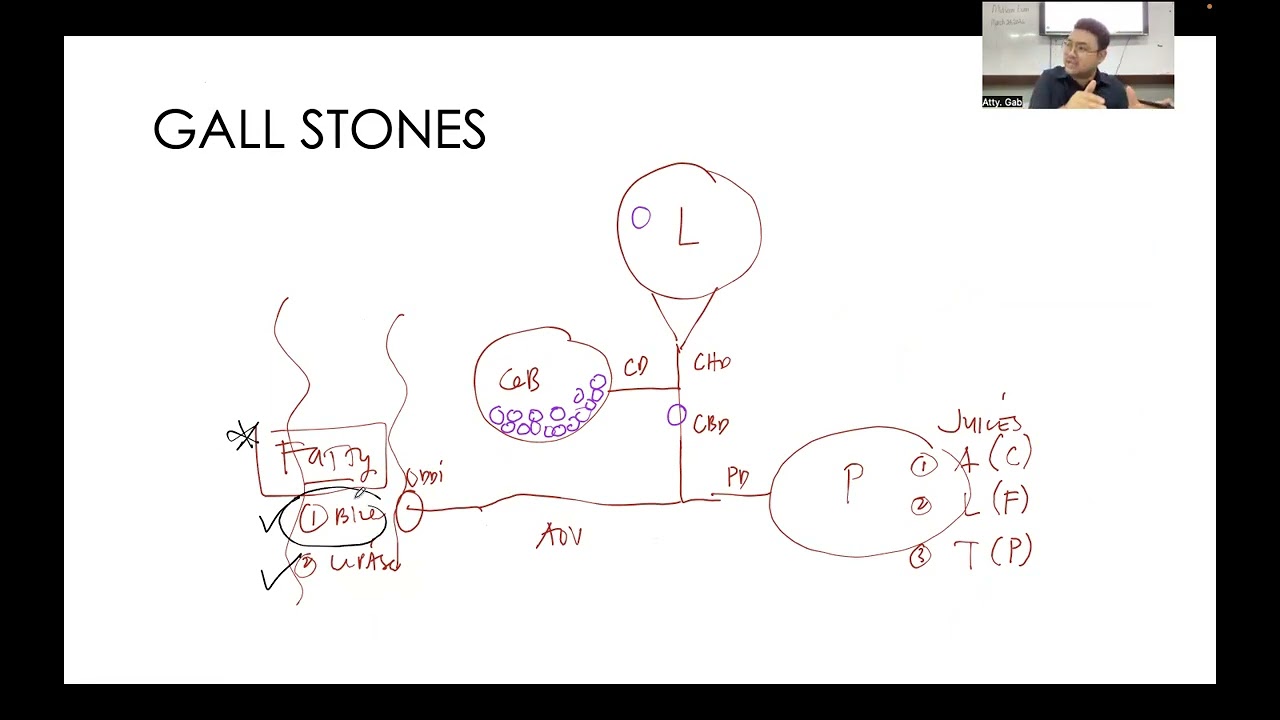 Gastro Series: Cholelithiasis & Cholecystitis
