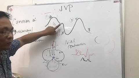 jvp(jugular venous pulse);canon a wave