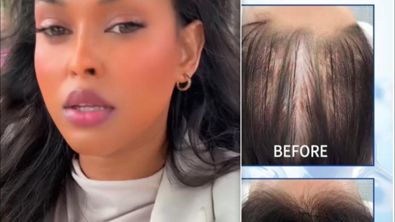 Sirta kaliya dhakhaatiirtu isku raaceen ii timaha lagu bixiyo 3 isbuuc