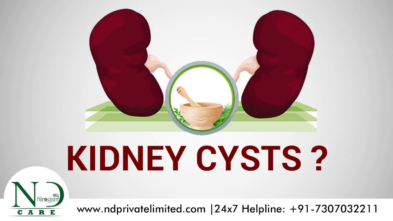 Kidney Cysts ?? Get Quick Healing with Ayurveda Dr. Navdeep Sharma
