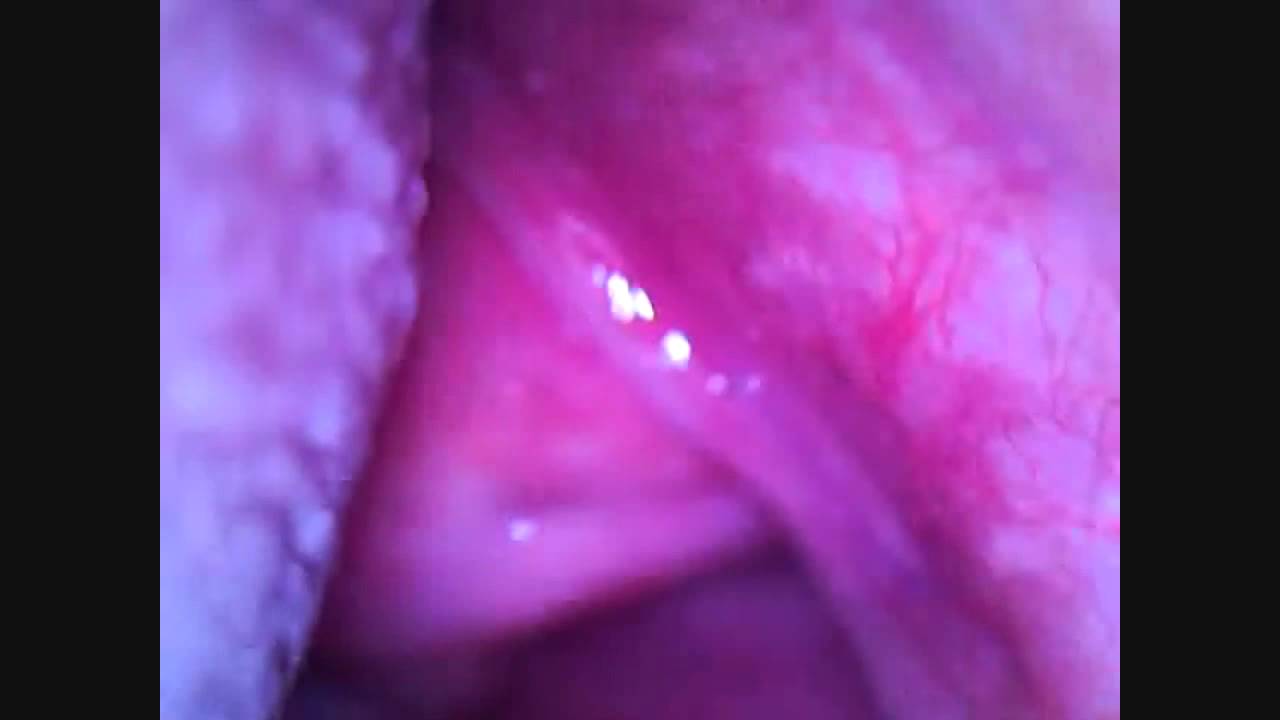 Inside The Mouth And Down The Throat A Magnified View Youtube