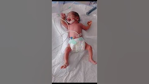 preterm new born baby on nasal cpap In nicu #nicunurse #viralvideo #nicunurse