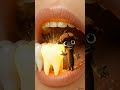 3 Powerful Home Remedies | Acne, Hair Fall & Yellow Teeth Solution#homeremedy #healthtips #natural