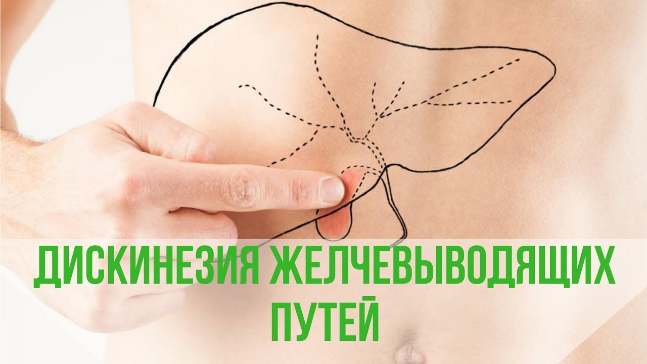 Дискинезия желчного пузыря - YouTube