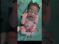 Moro Reflex Explained in 45 Seconds