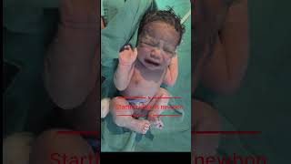 Moro Reflex Explained in 45 Seconds