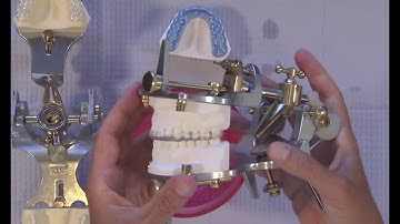 Case of the Week: Occlusal Splints