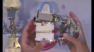 Case Of The Week Occlusal Splints