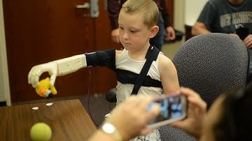 UCF Engineering students build prosthetic arm for young boy