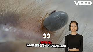 🦠 Chronic Lyme Disease: Myths vs. Facts – The Truth Revealed! ✅❌