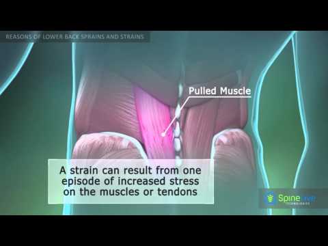 Lower Back Sprain And Strain Reasons