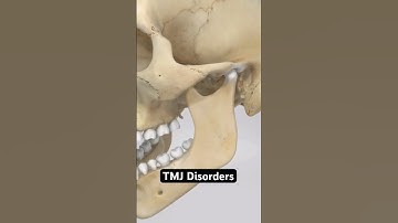 Why does my jaw pop, click or lock? (3D Animation)
