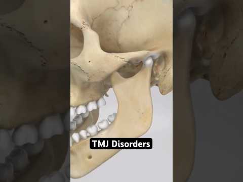 Why does my jaw pop, click or lock? (3D Animation)