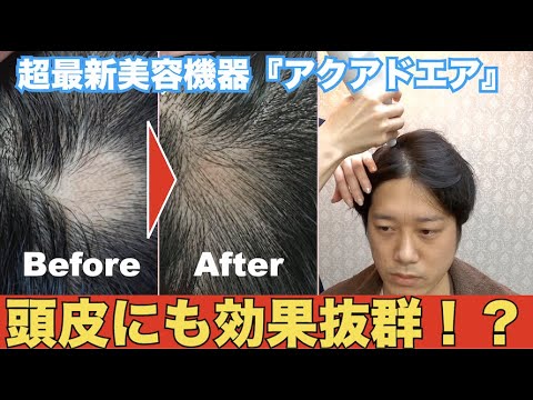 衝撃 頭皮にも効果抜群 アクアドエア でスカルプケア Youtube