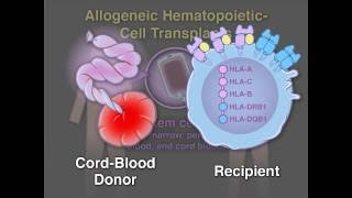 Cord-Blood Transplant