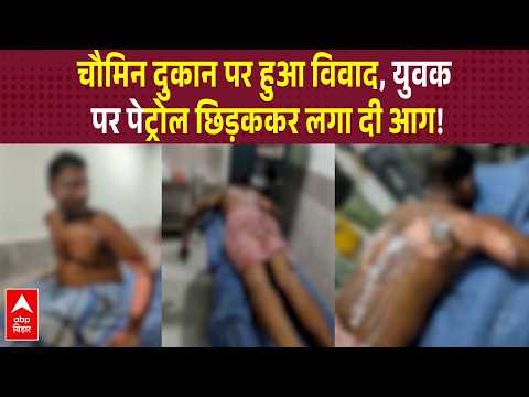 Youth Allegedly Doused in Petrol and Set on Fire in Patna, Two Injured | ABP BIHAR