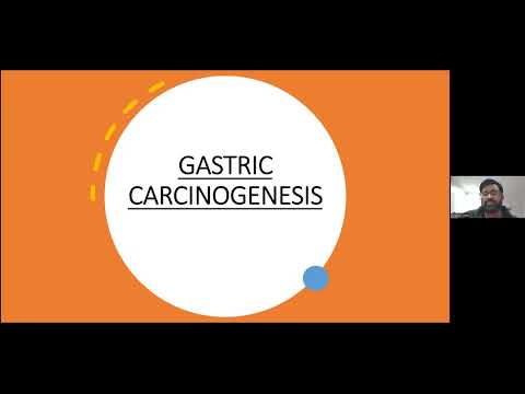 G-ECHO Fellows Medical:  Pre-malignant conditions of the stomach, polyps and gastric cancer
