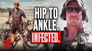 Flesh-Eating Bacteria, Two Strokes, Coded Twice: Zachary Garner Didn’t Quit