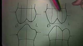 Dental Anatomy: Mandibular Premolars Review