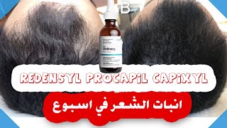 انبات الشعر في اسبوع  | في منتج واحد 3 مواد أقوى من المينوكسيديل مرتين ونص  ordinary multi-peptide