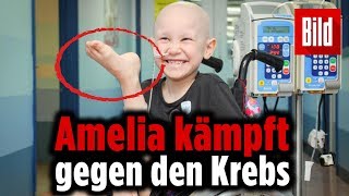 Deshalb haben die Ärzte ihr Bein falsch angenäht Deshalb haben die Ärzte ihr Bein falsch angenäht