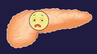 Beta Cell Exhaustion in Type 2 Diabetes Mellitus - Insulin Resistance - Pathogenesis of Diabetes screenshot 1