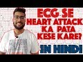 ECG reading in Hindi Language part 2 || How to read ECG signal part 2 || Medical Guruji