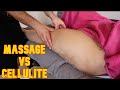 تدليك الأنسجة العميقة يساعد على التخلص من السيلوليت في الساقين 