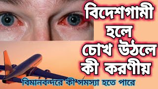 Conjunctivitis | What should you do