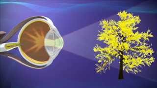 Understanding Astigmatism